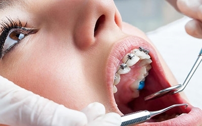 Image de la catégorie Orthodontie